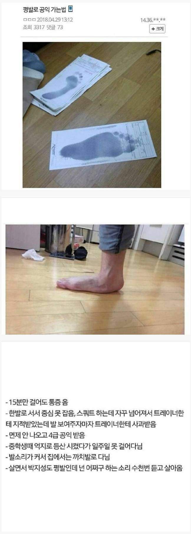 평발을 인증했던 사람의 레전드 사연