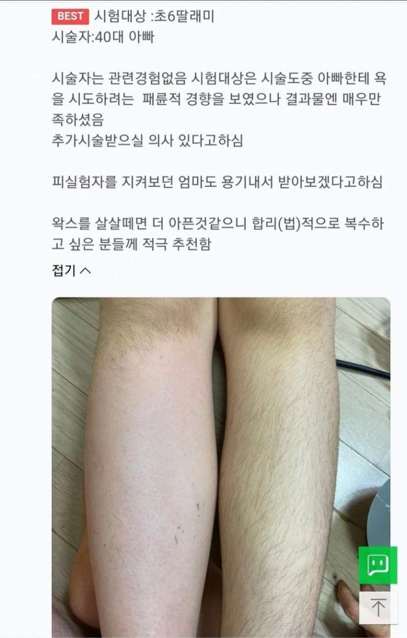 초6 딸 왁싱후기
