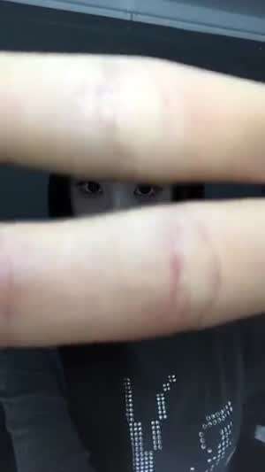 트리플에스 지연