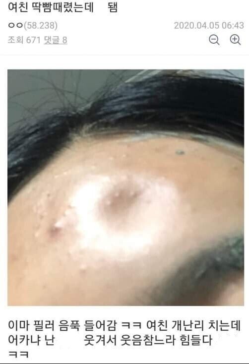 여친 딱밤 대참사 현장