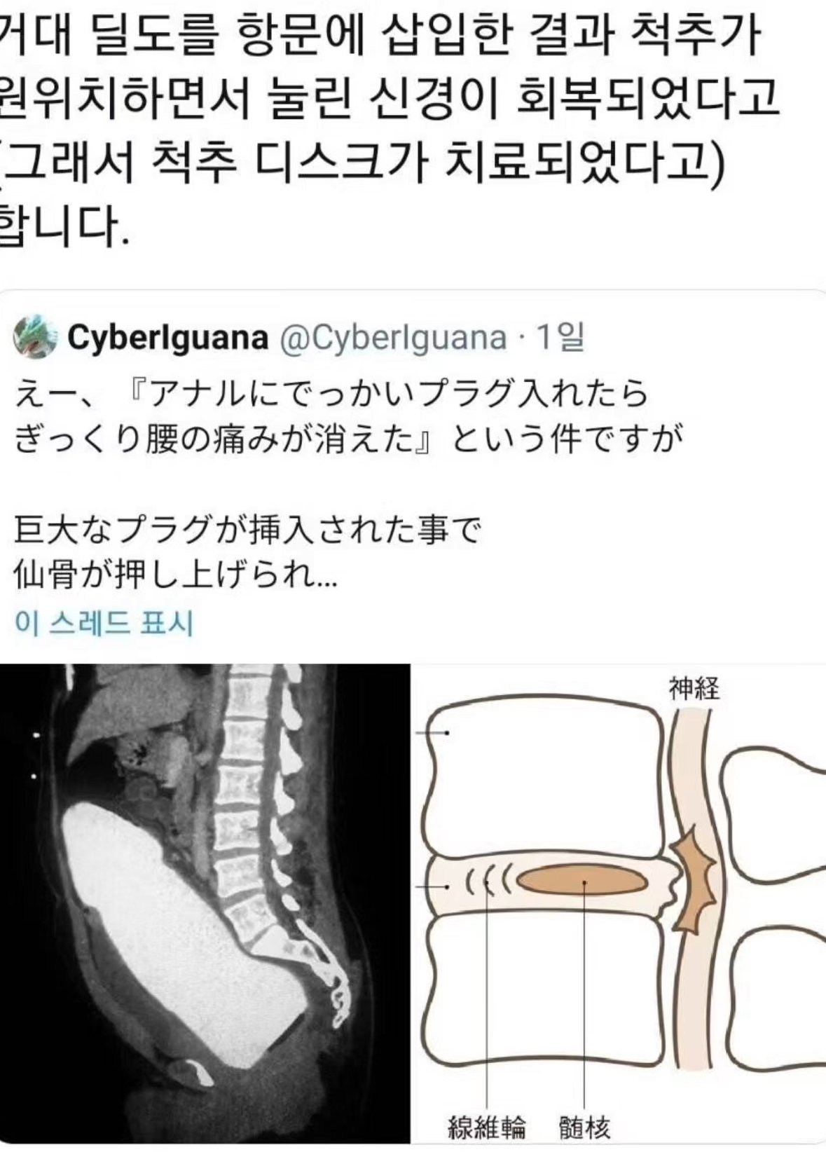 거대 딜도를 항문에 삽입했더니 ㄷㄷㄷ