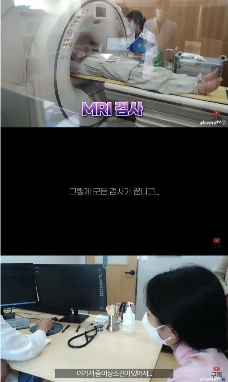 정말 운좋게 췌장암 발견해서 치료 받은 유튜버