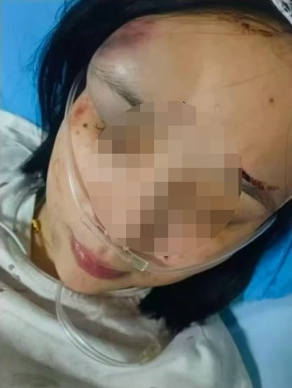 중국,‘학폭’ 처분 항의했더니 중국공안 시민들 집단구타 ,가축용 트럭 태워 연행