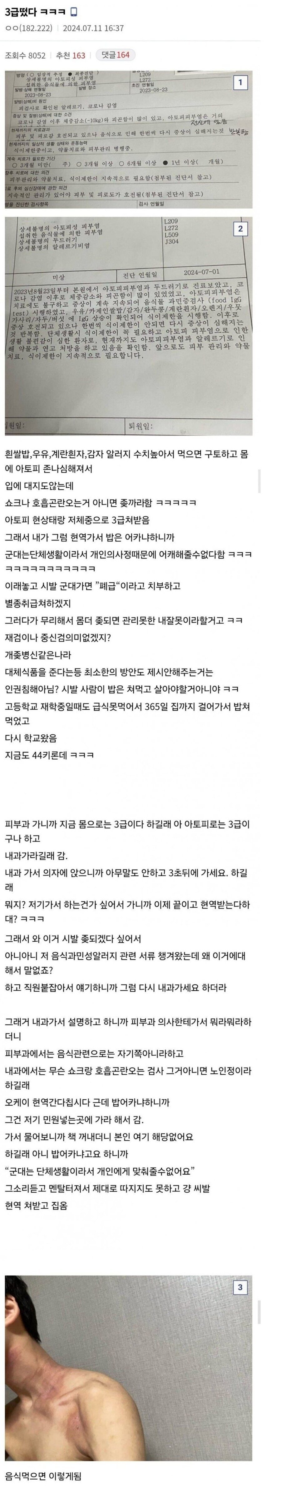 쌀밥, 우유, 계란, 감자 알레르기인데 현역 판정