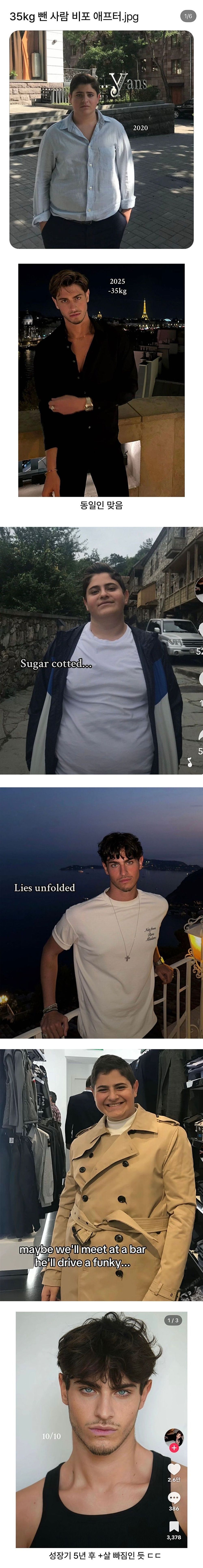 35kg감량 비포 애프터