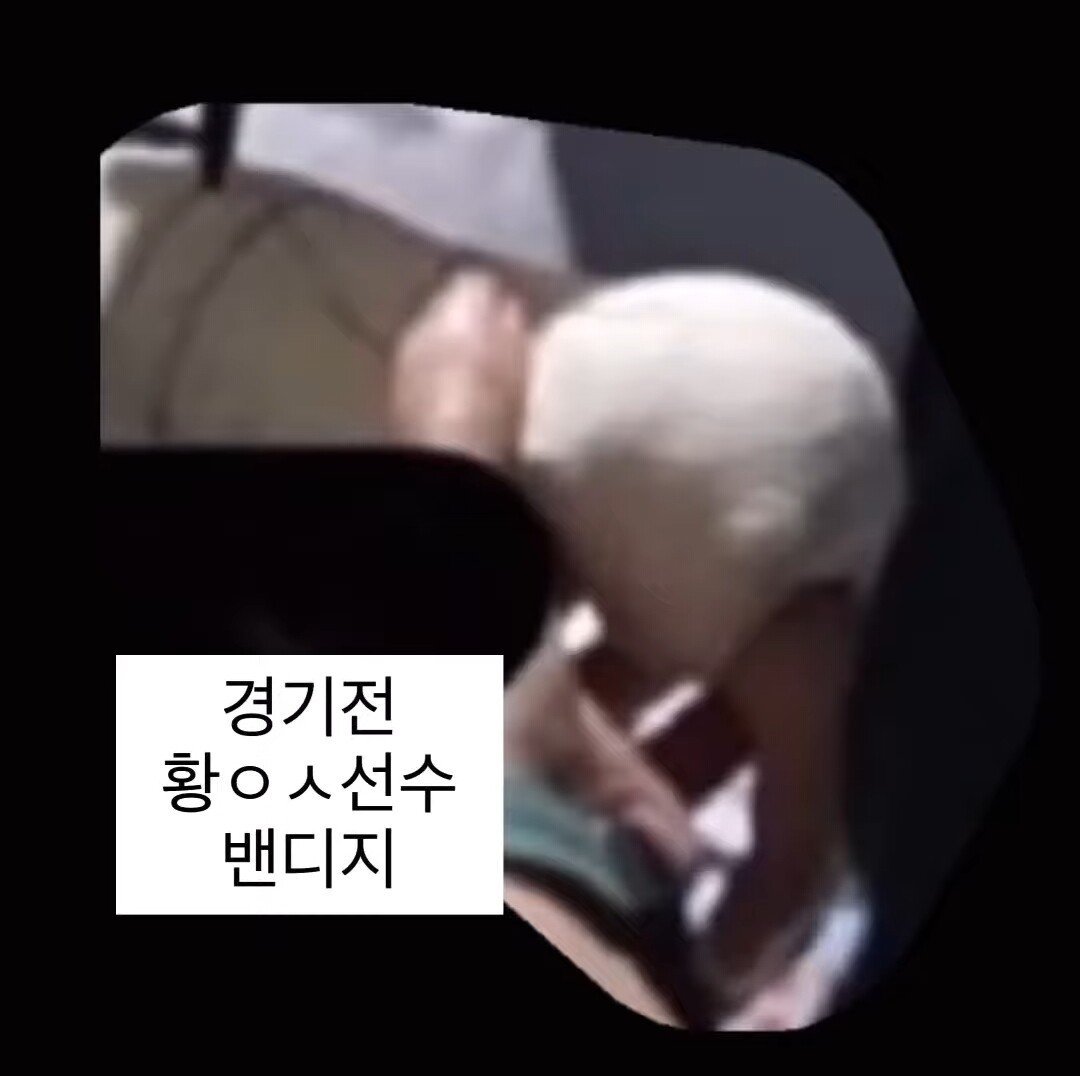 격투기 테이핑 금지 이전 황인수vs명현만 테이핑 차이