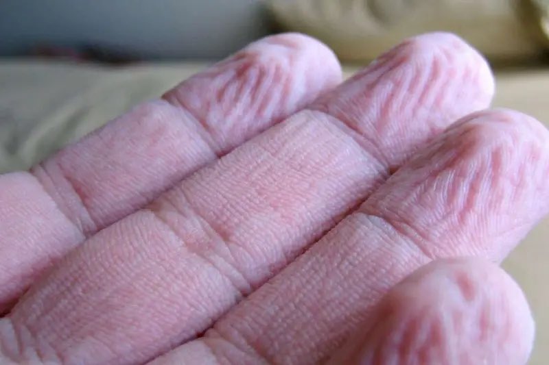 젖은 손가락 끝에 주름이 생기는 이유