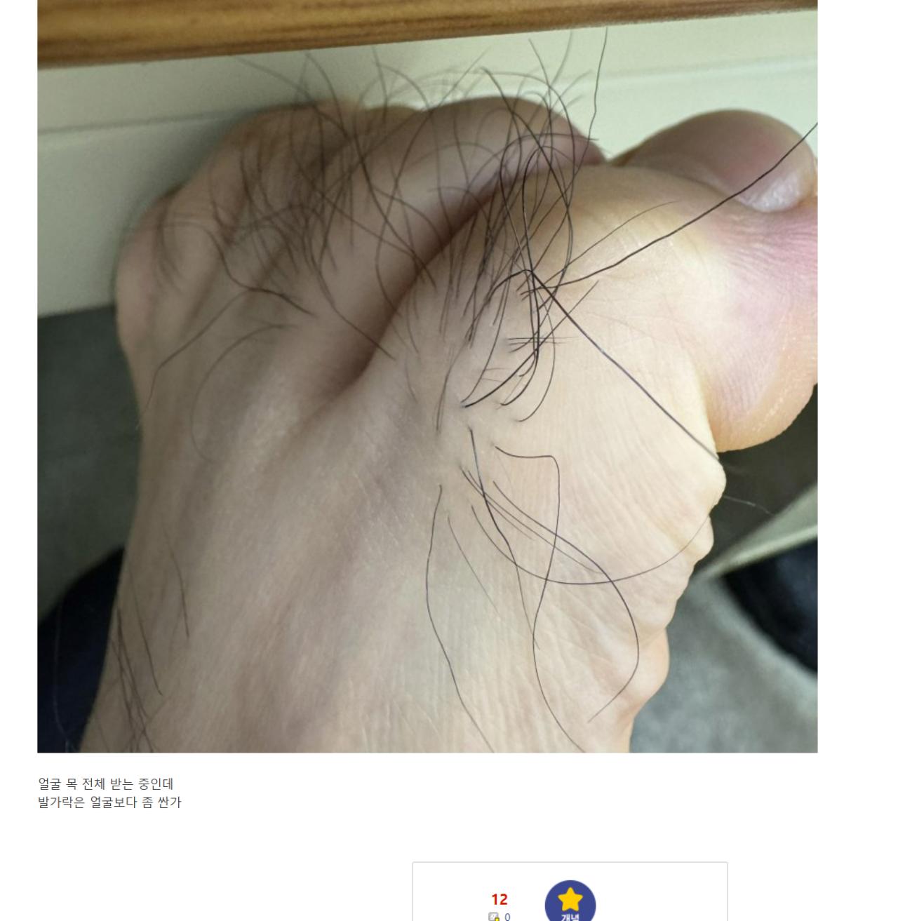 혐)발가락 털 제모 받고 싶은 디시인