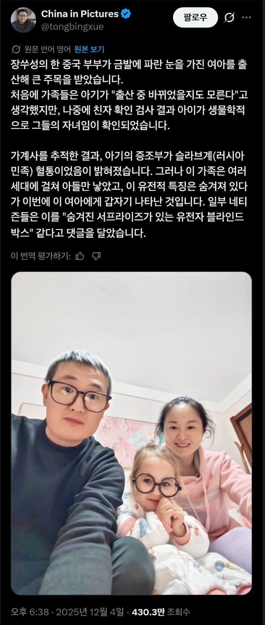 백인을 출산한 중국인 부부